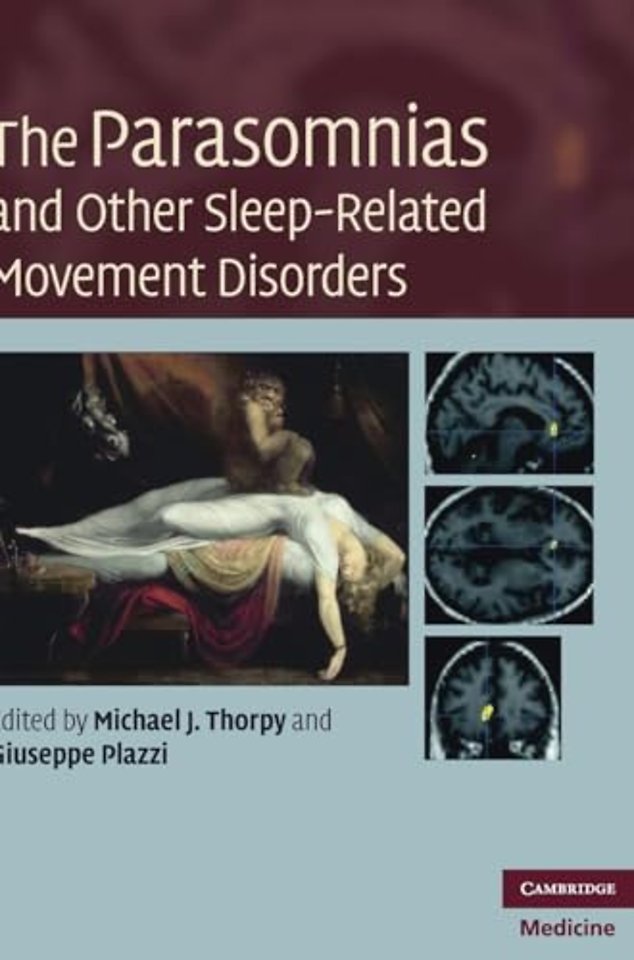 The Parasomnias and Other Sleep-Related Movement Disorders
