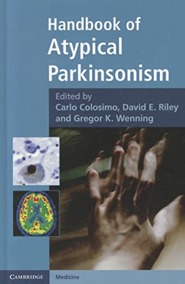 Handbook of Atypical Parkinsonism