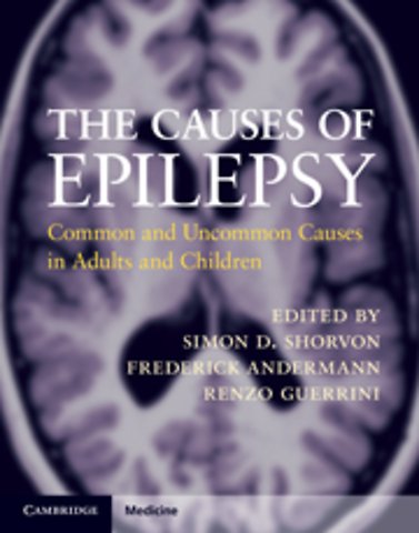 The Causes of Epilepsy