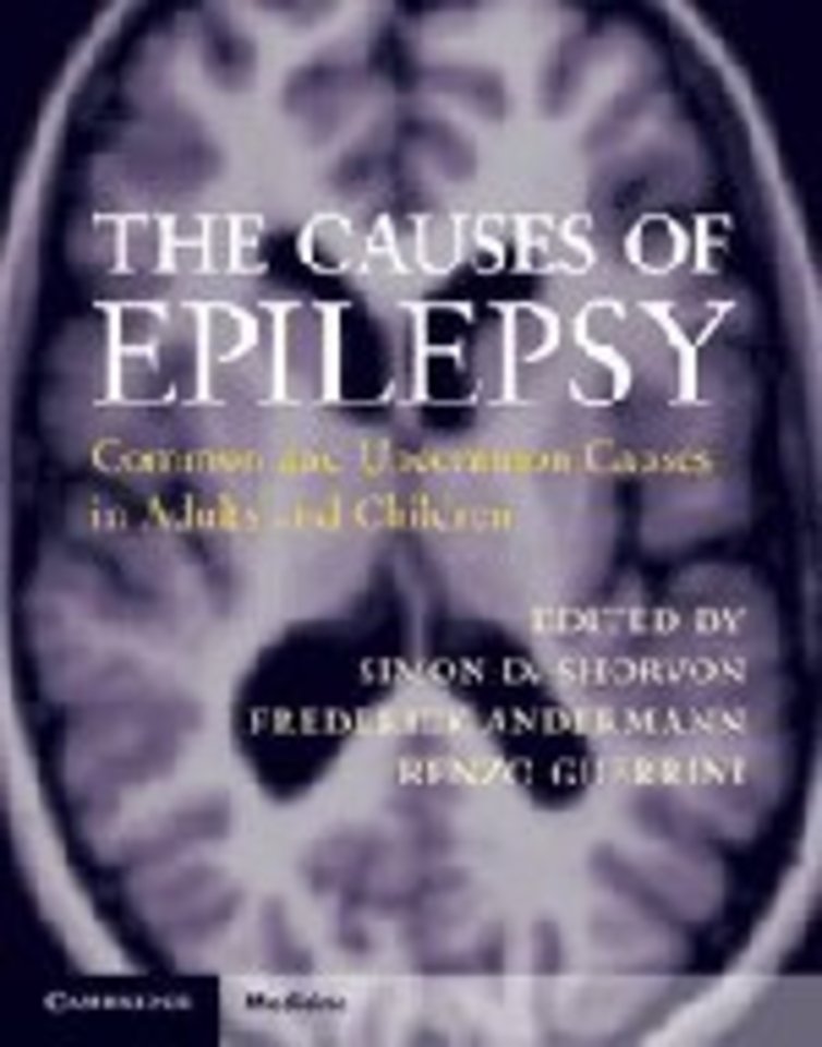 The Causes of Epilepsy