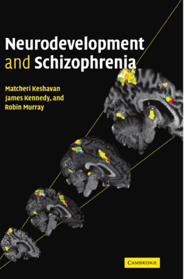 Neurodevelopment and Schizophrenia