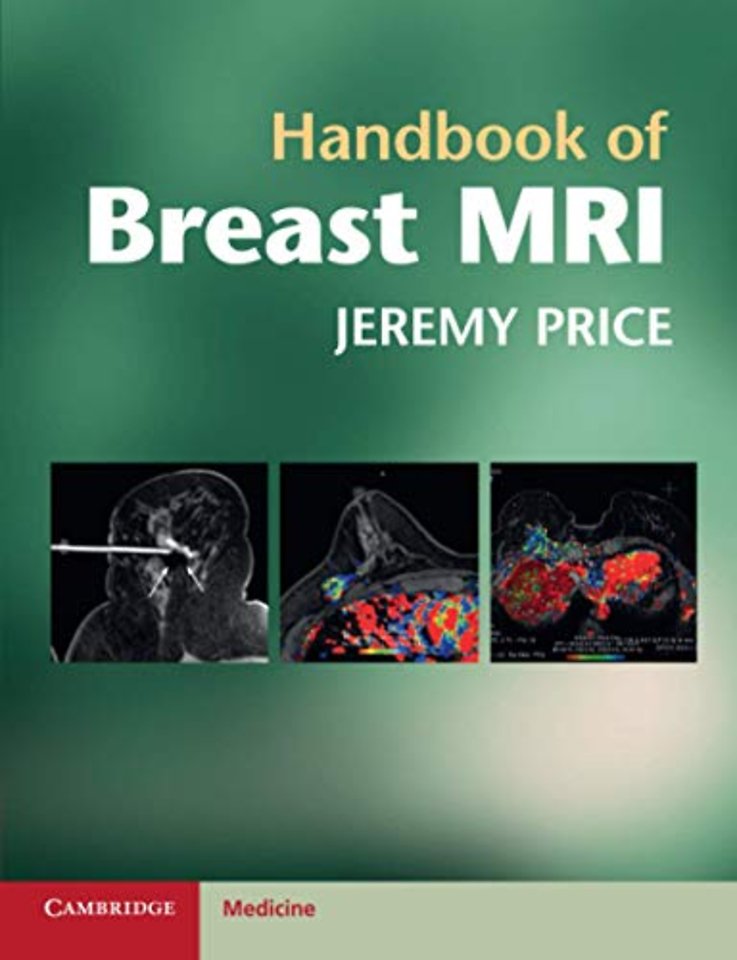 Handbook of Breast MRI