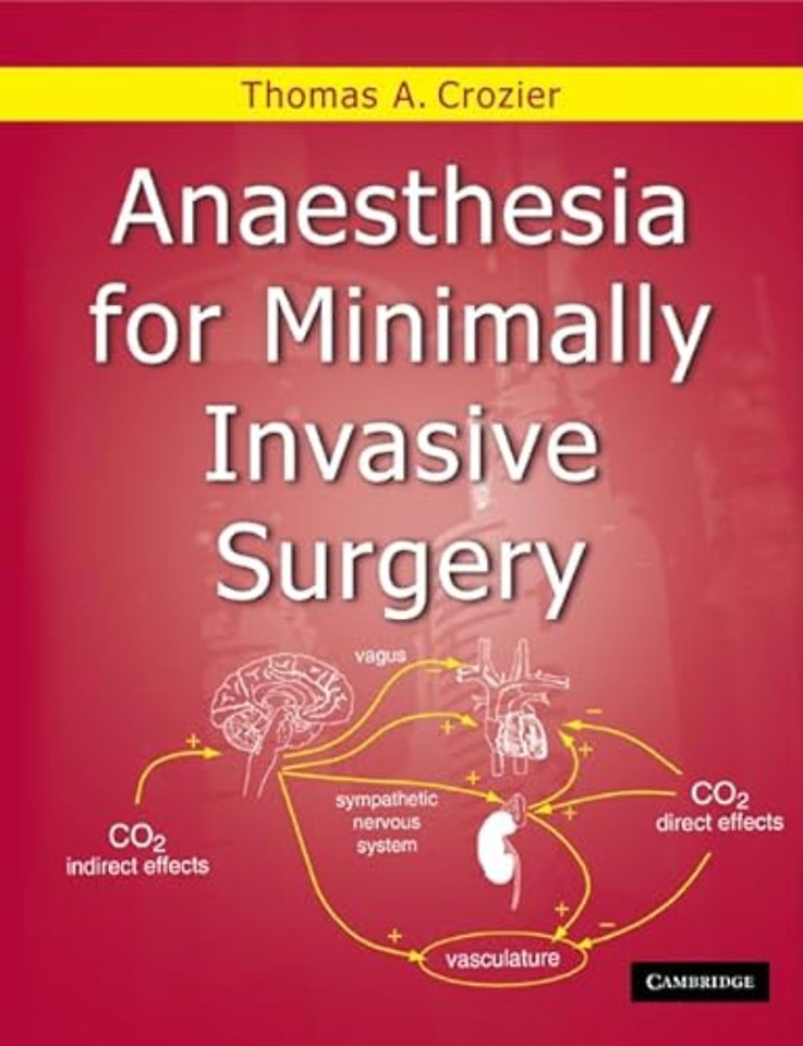 Anaesthesia for Minimally Invasive Surgery