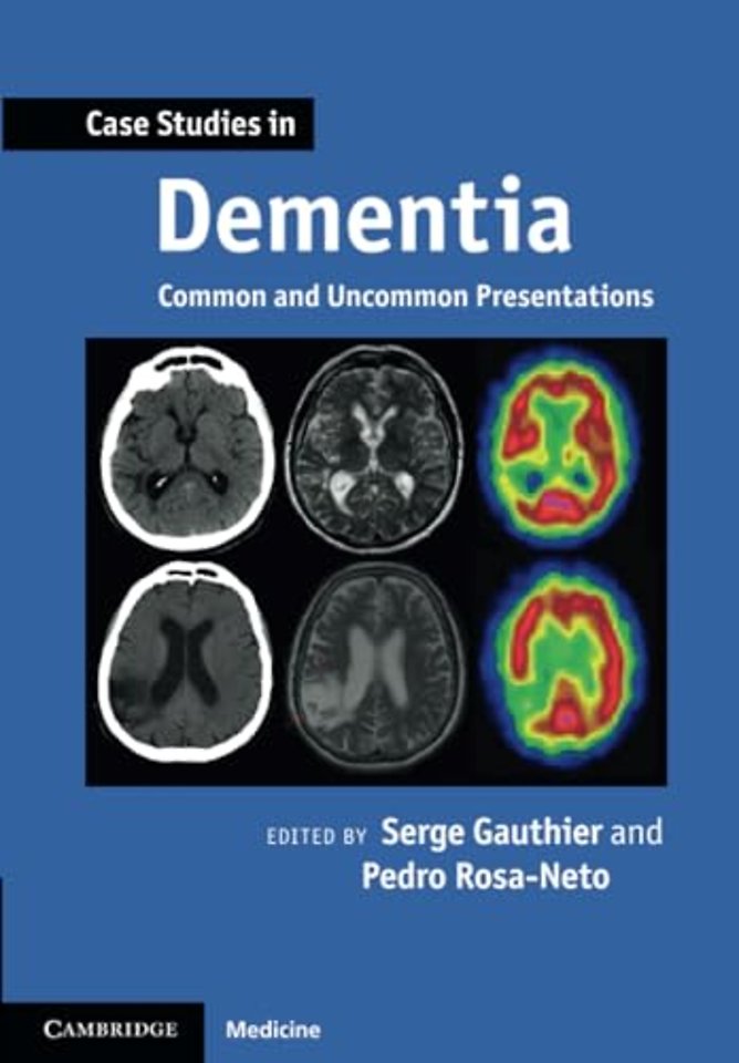 Case Studies in Dementia: Volume 1