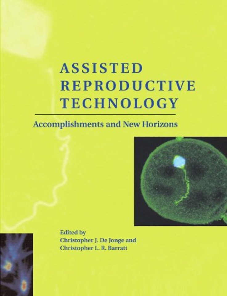 Assisted Reproductive Technology