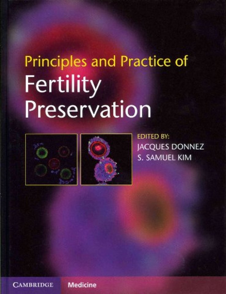 Principles and Practice of Fertility Preservation