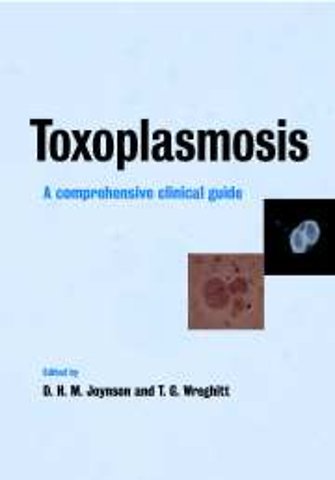 Toxoplasmosis