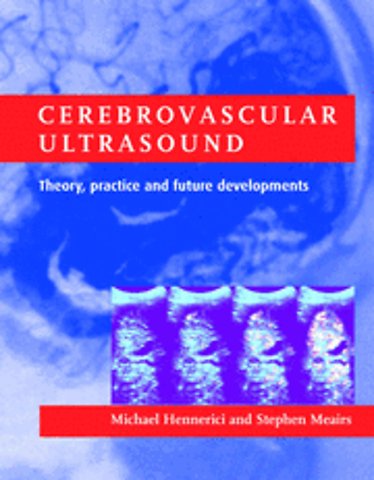 Cerebrovascular Ultrasound