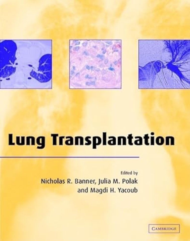 Lung Transplantation