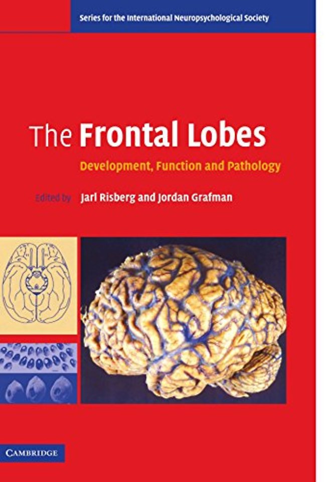 The Frontal Lobes