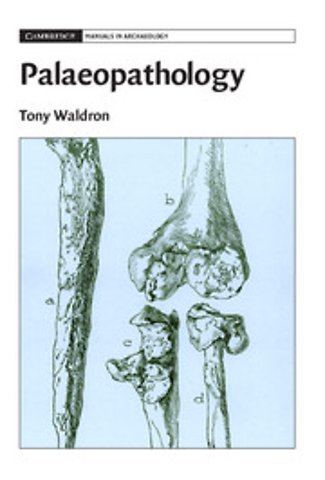 Palaeopathology