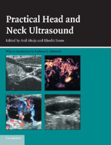 Practical Head and Neck Ultrasound