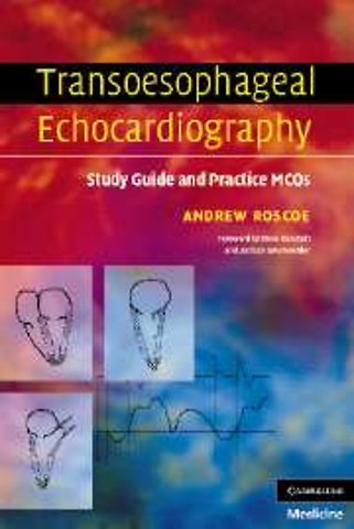 Transoesophageal Echocardiography