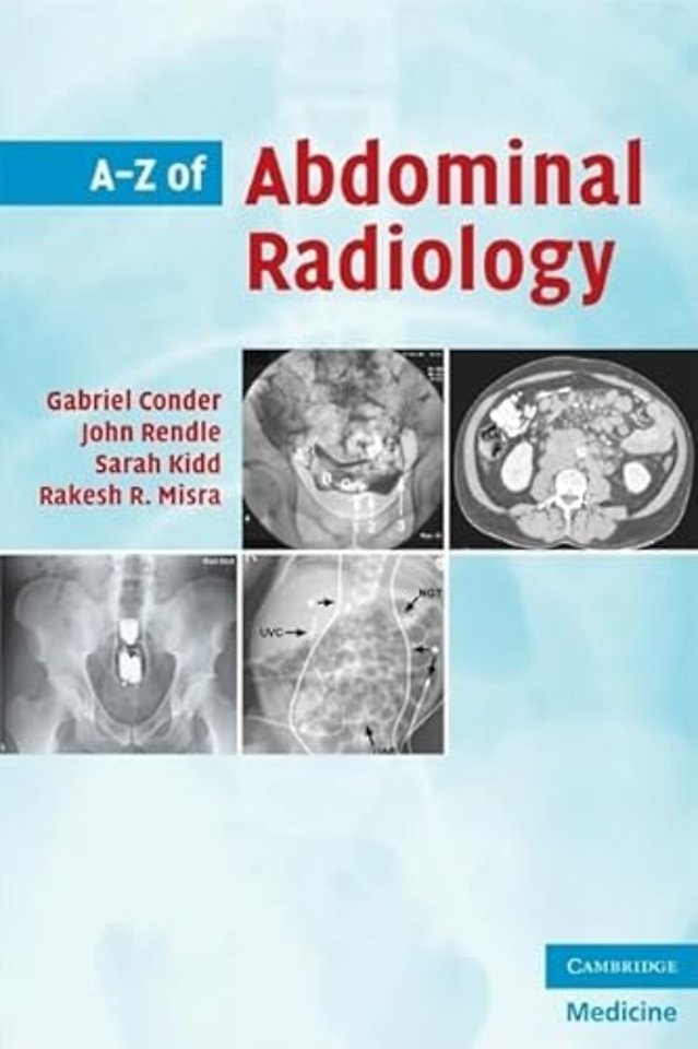 A-Z of Abdominal Radiology