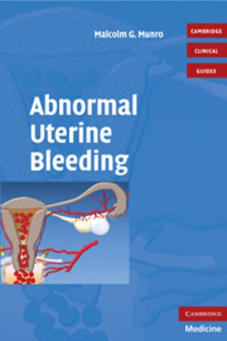 Abnormal Uterine Bleeding with DVD