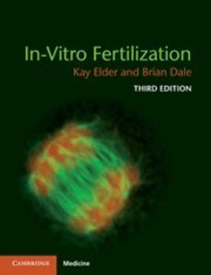 In-Vitro Fertilization  