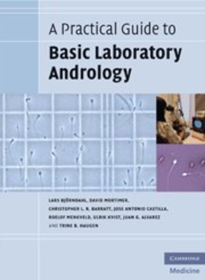 A Practical Guide to Basic Laboratory Andrology
