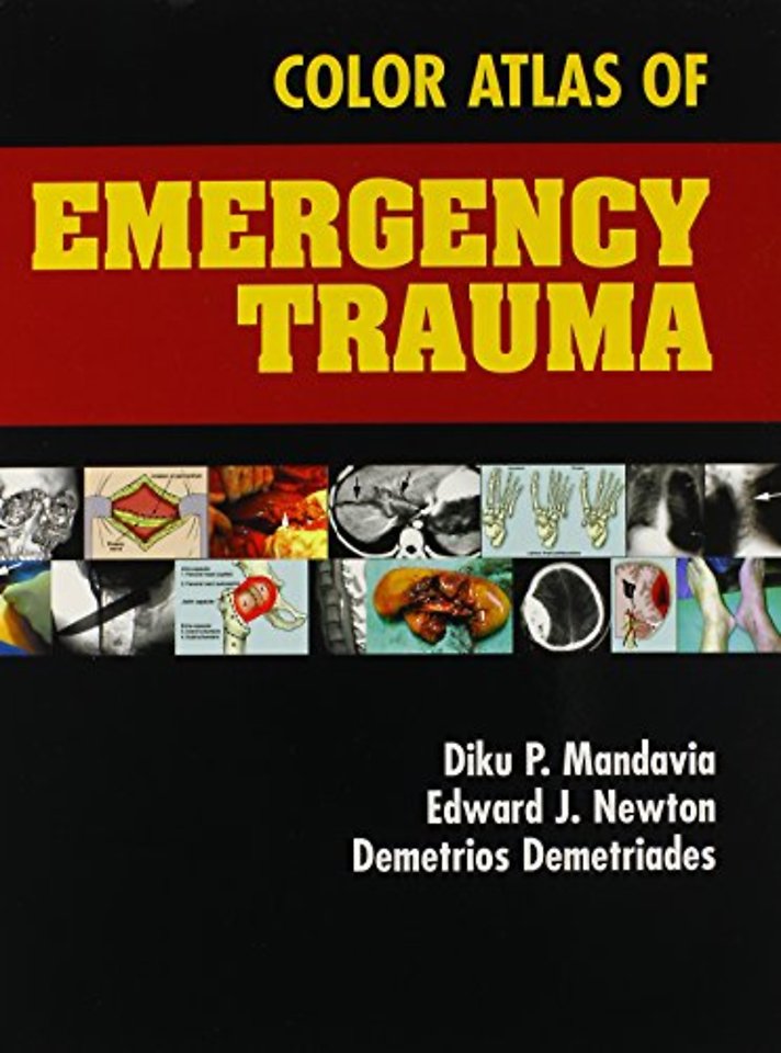 Color Atlas of Emergency Trauma