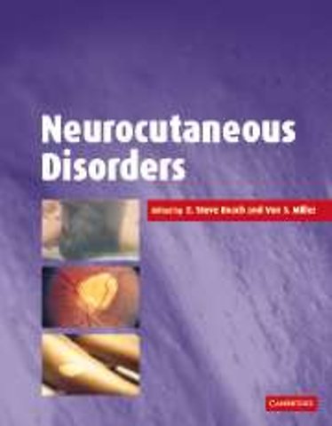 Neurocutaneous Disorders