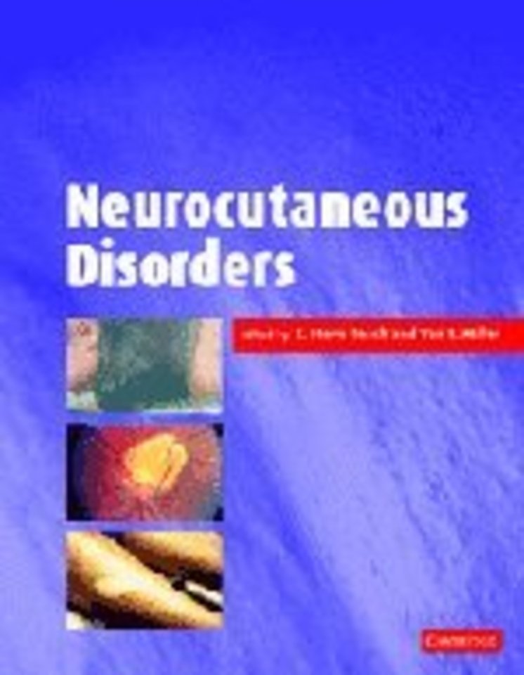 Neurocutaneous Disorders