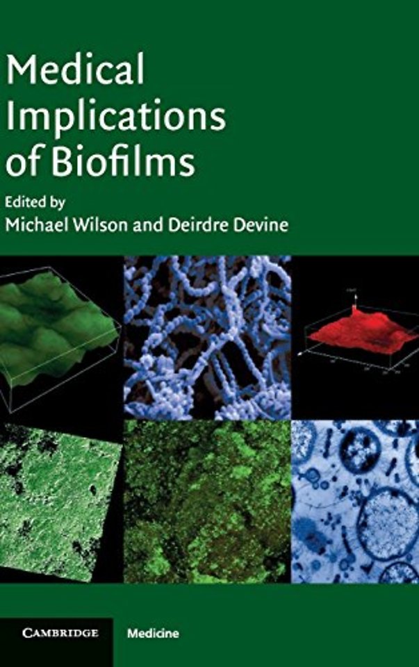 Medical Implications of Biofilms
