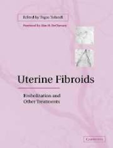Uterine Fibroids