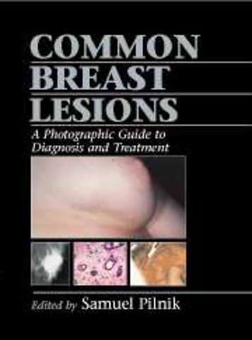 Common Breast Lesions