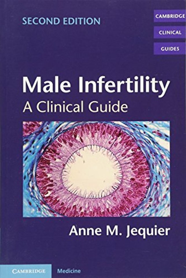 Male Infertility