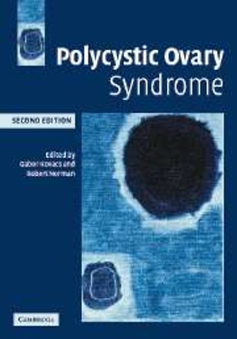 Polycystic Ovary Syndrome