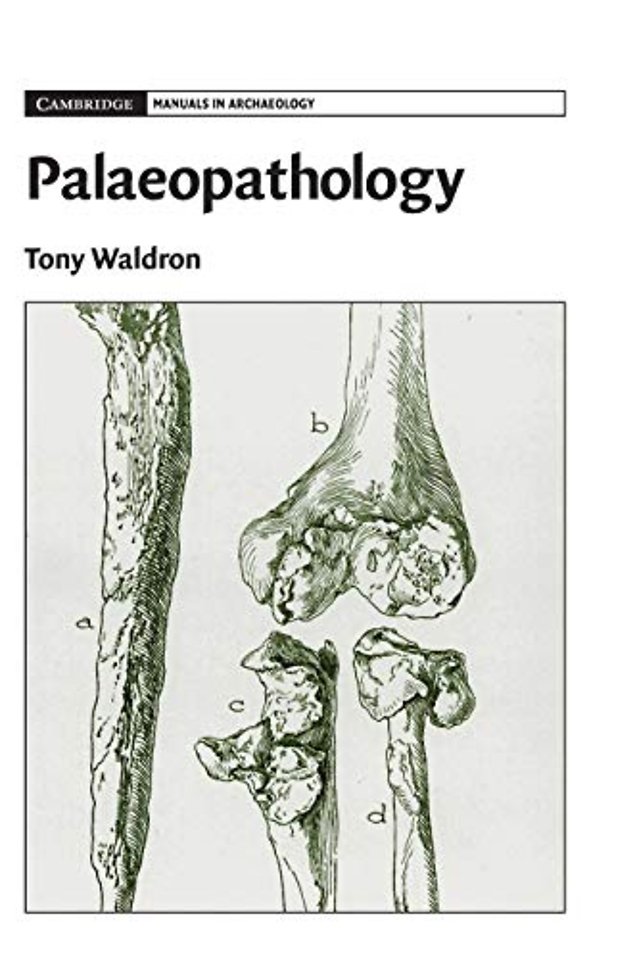 Palaeopathology