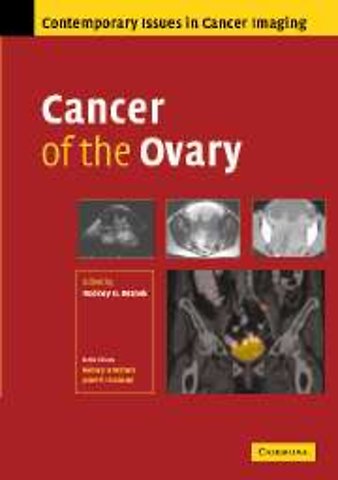 Cancer of the Ovary