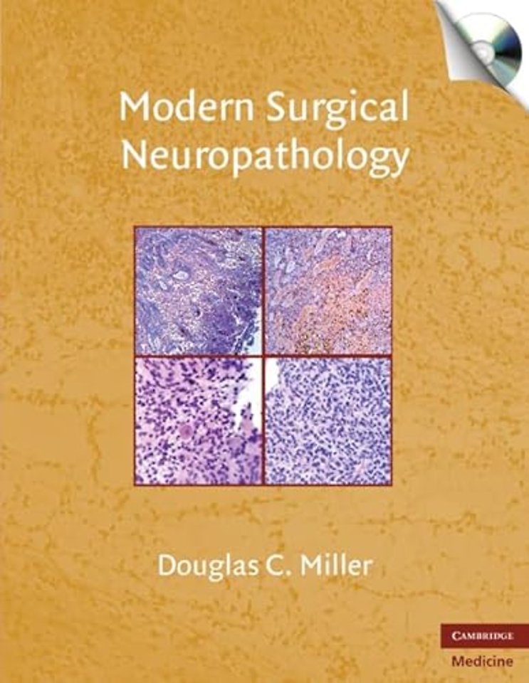 Modern Surgical Neuropathology with CD-ROM