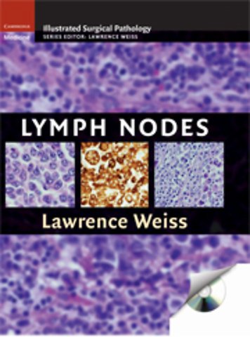 Lymph Nodes
