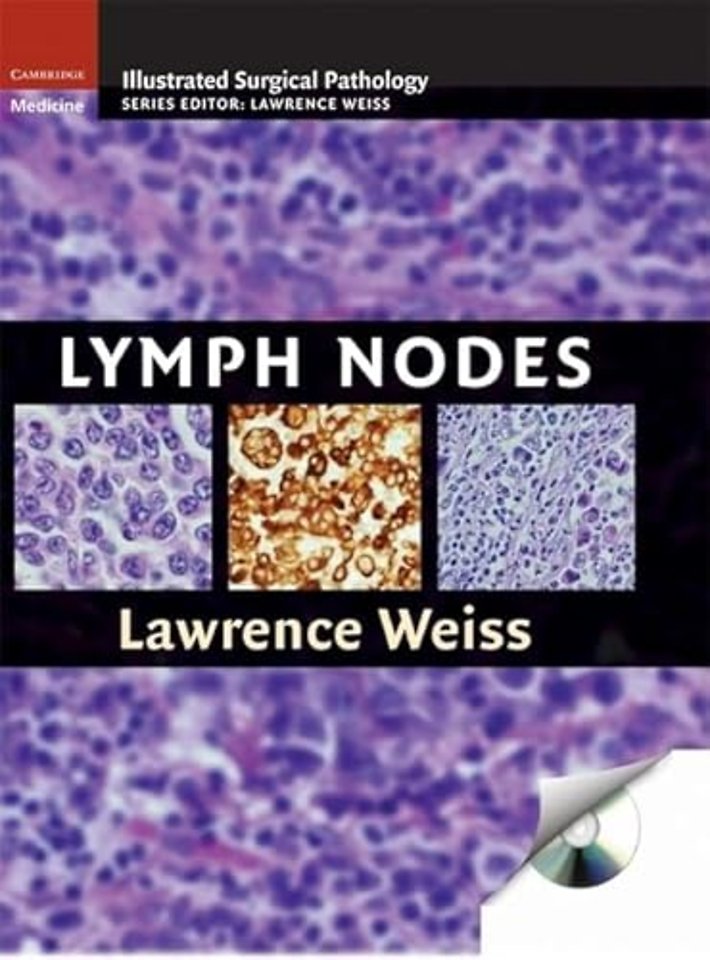 Lymph Nodes
