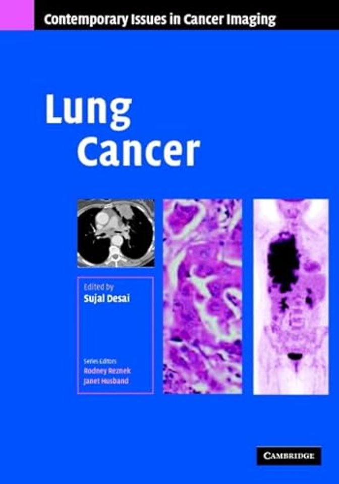 Lung Cancer