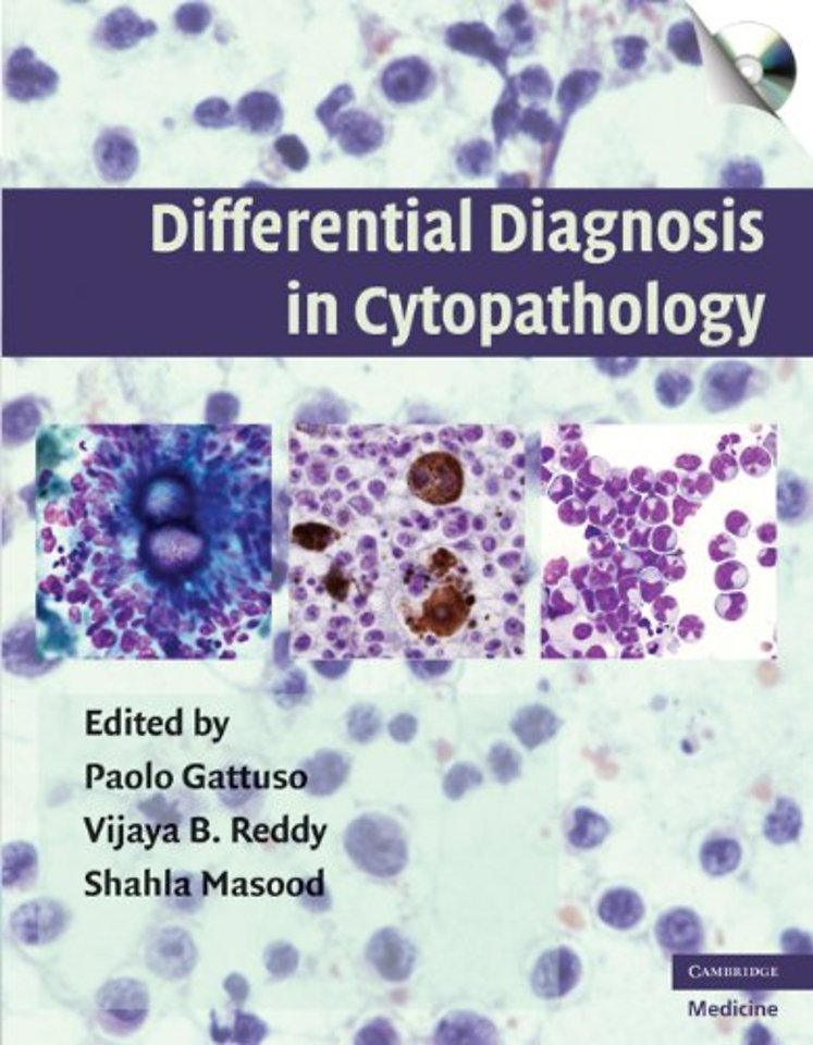 Differential Diagnosis in Cytopathology with CD-ROM