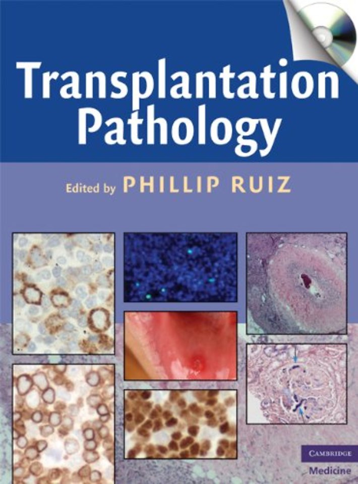 Transplantation Pathology