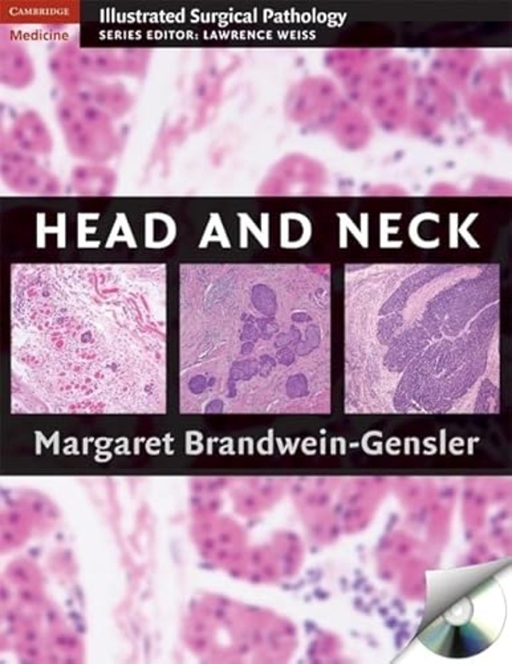 Head and Neck