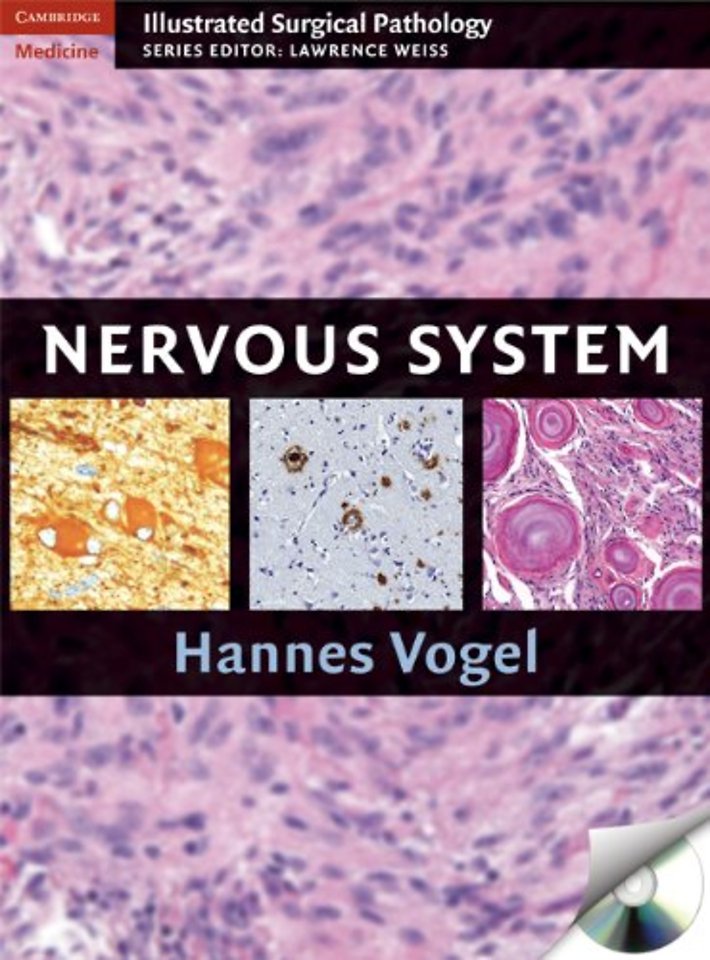 Nervous System