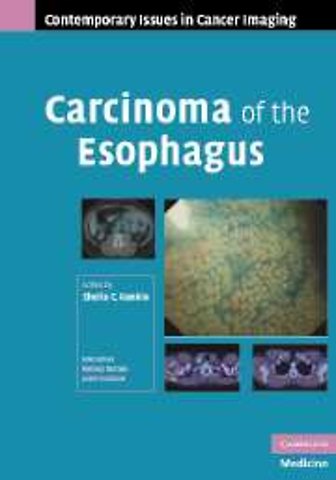 Carcinoma of the Esophagus