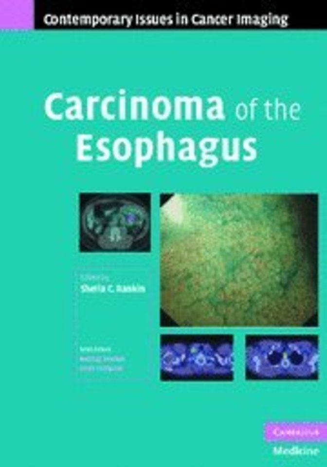 Carcinoma of the Esophagus