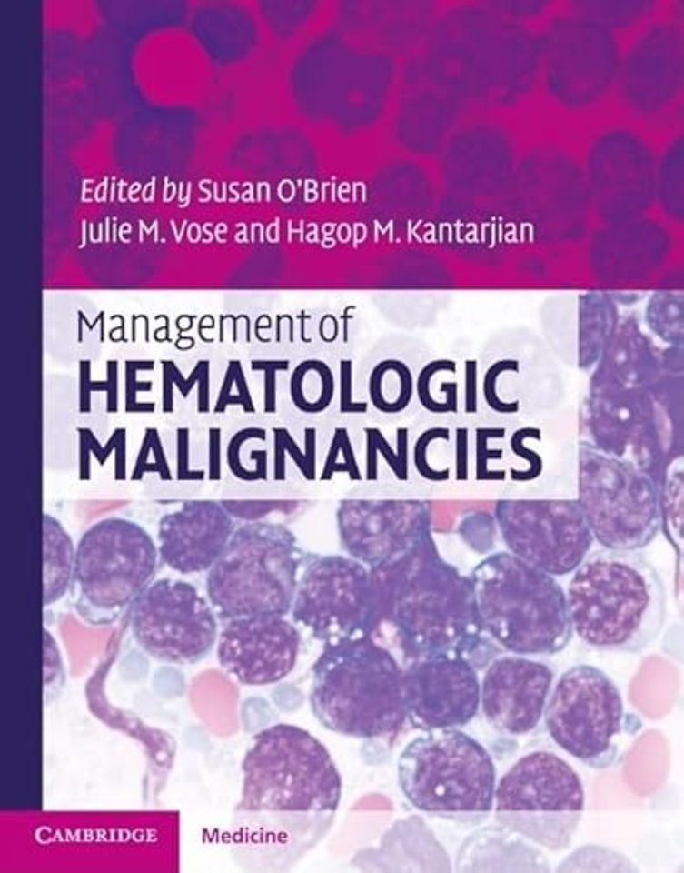 Management of Hematologic Malignancies