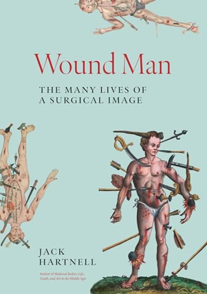 Wound Man – The Many Lives of a Surgical Image