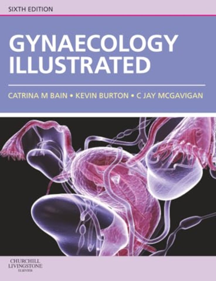 Gynaecology Illustrated