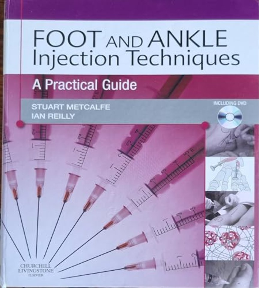 Foot and Ankle Injection Techniques