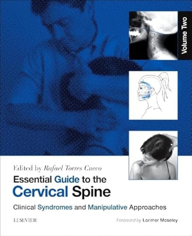 Essential Guide to the Cervical Spine - Volume Two