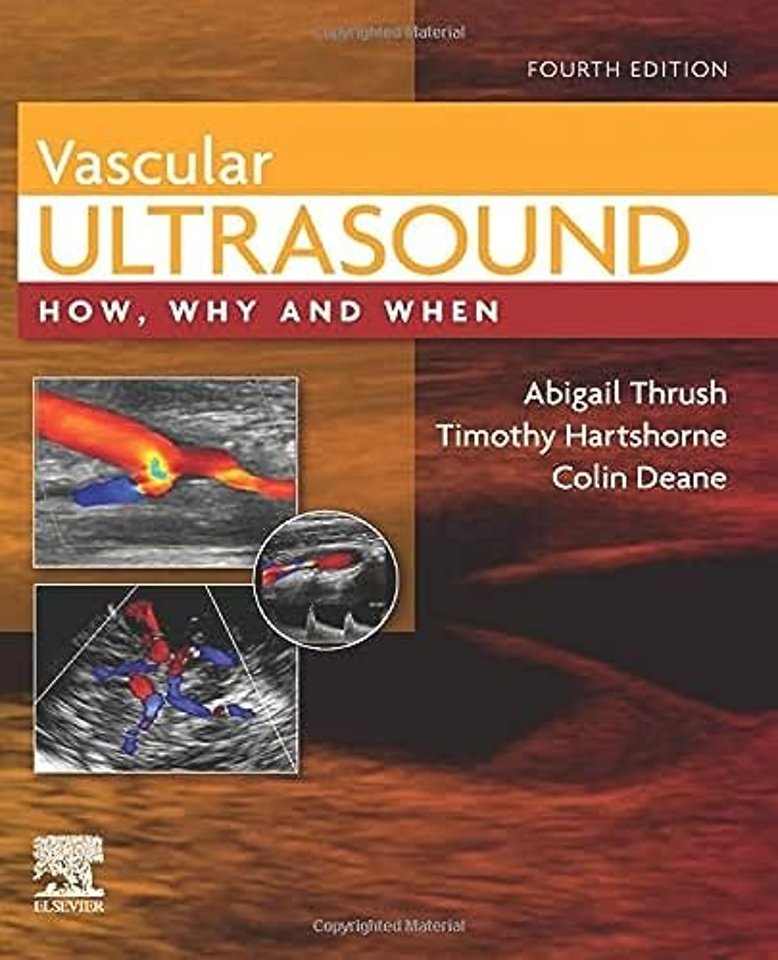 Vascular Ultrasound