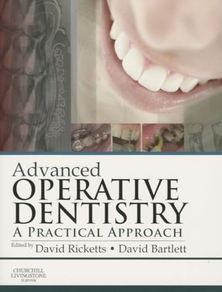 Advanced Operative Dentistry