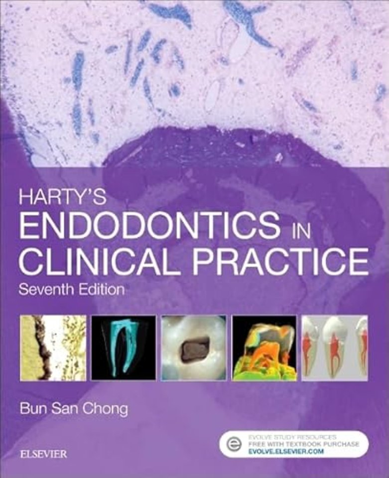 Harty's Endodontics in Clinical Practice