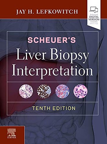 Scheuer's Liver Biopsy Interpretation